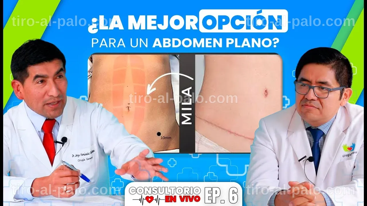 Alternativa a la Abdominoplastia: La Revolución Estética