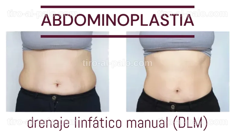 Varias opciones para conseguir un vientre plano sin cirugía.