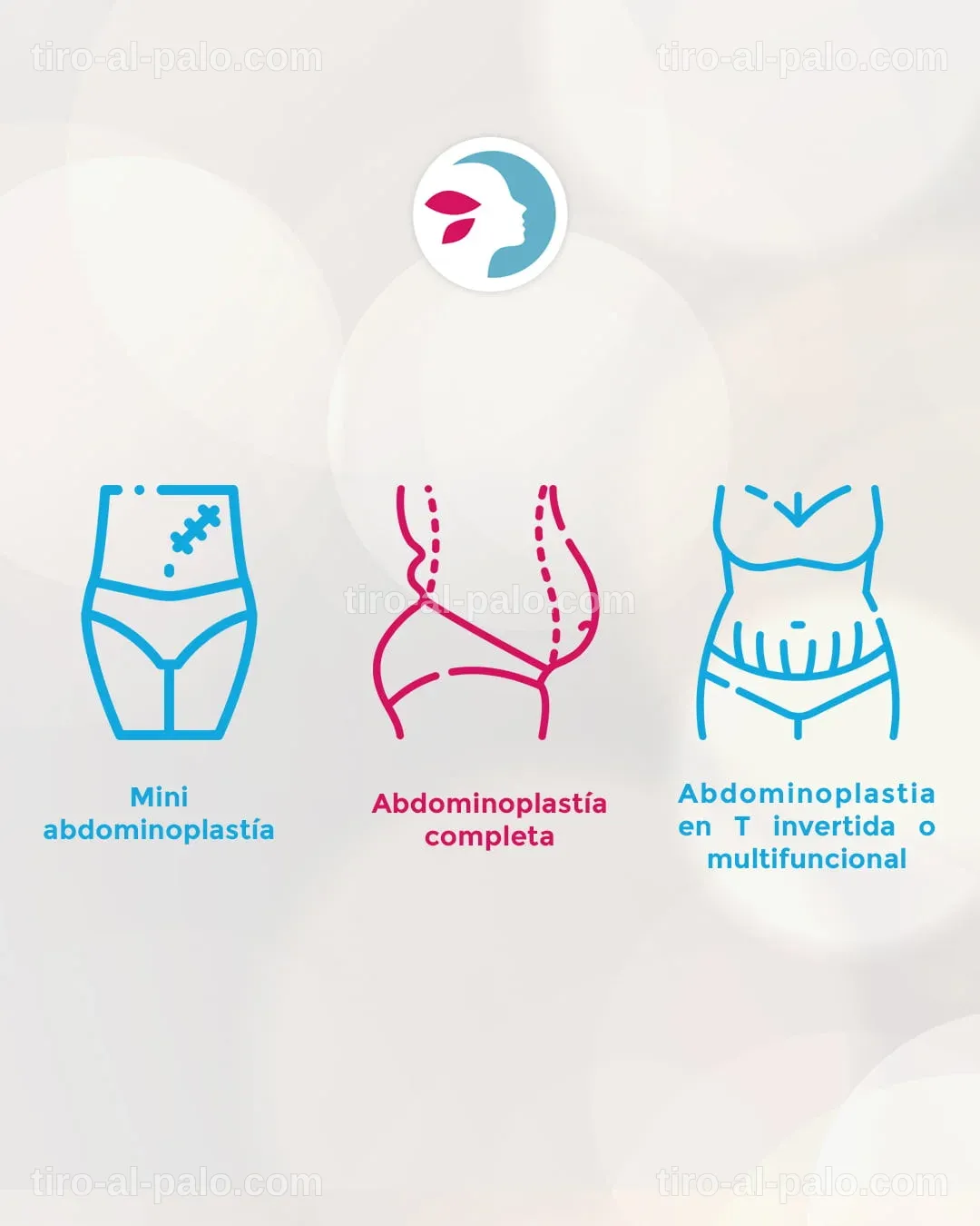 Detalles sobre la reducción de abdomen en Clínica Menorca.