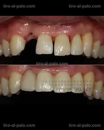 Diversas alternativas dentales en una clínica, incluyendo puentes y prótesis.