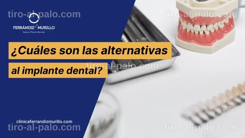 Alternativa Implante Dental: Revolución en Odontología