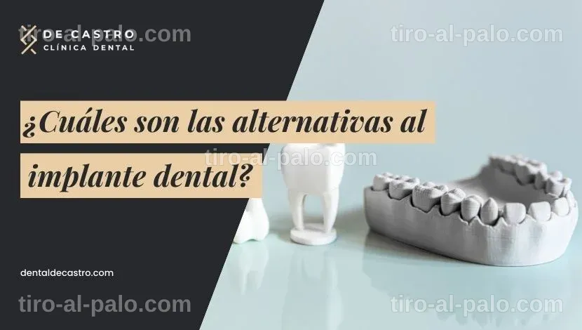 Alternativas para el 2026 para quienes prefieren no usar implantes dentales.