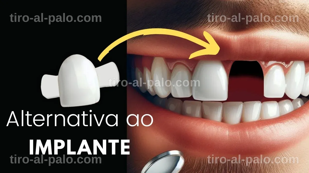 Descripción del proceso de autotrasplante dental como alternativa a los implantes.