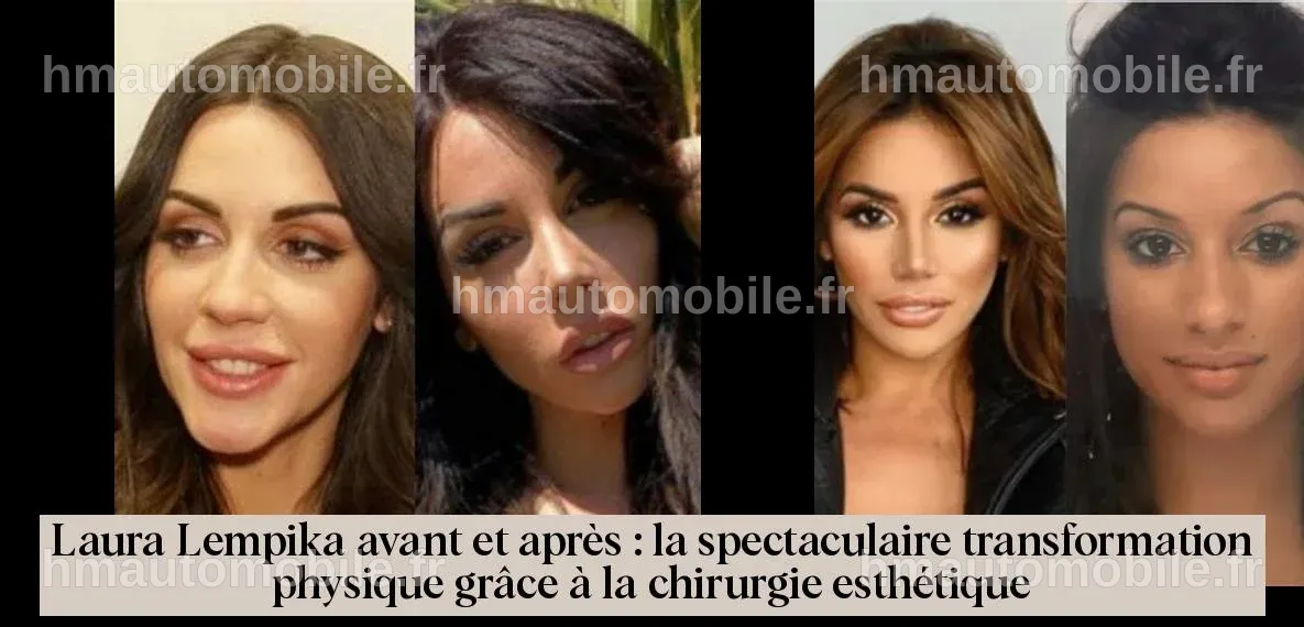 Laura Lempika avec des traits modifiés après des interventions esthétiques.