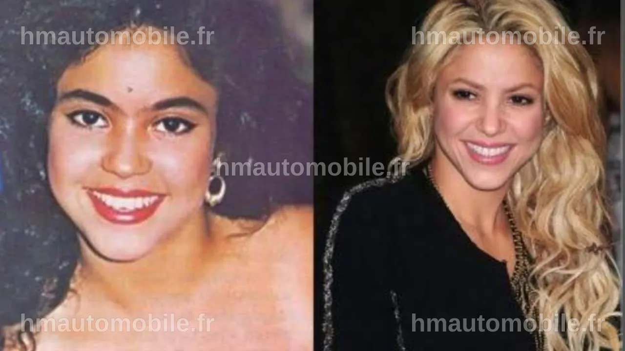 Comparaison de Shakira avant et après les changements esthétiques.