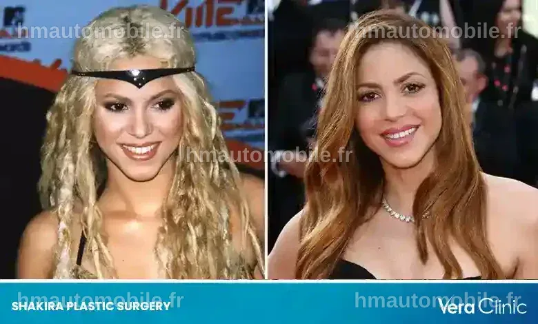 Évolution de l'apparence de Shakira au fil des ans.